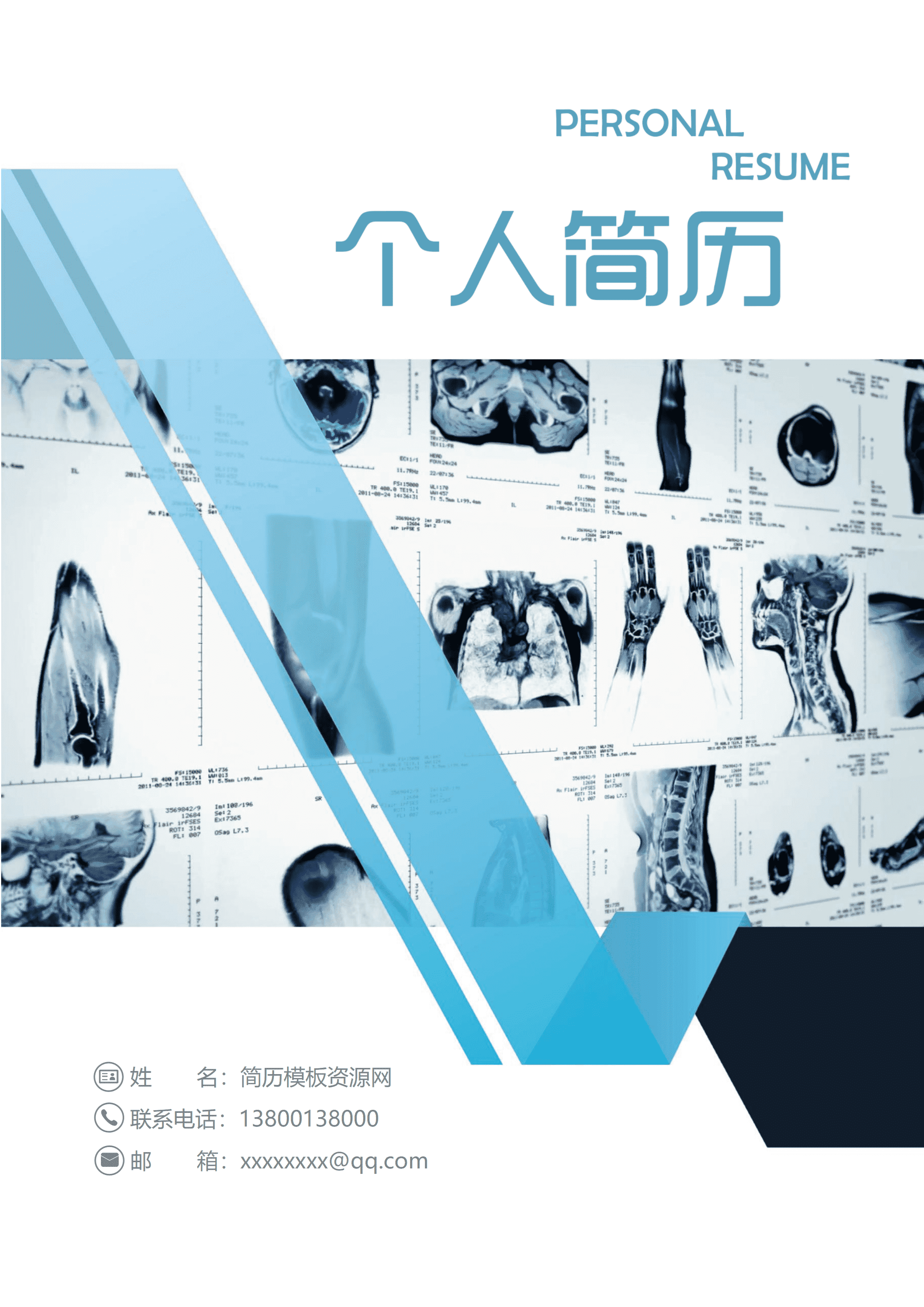 GND0251医学影像专业简历/