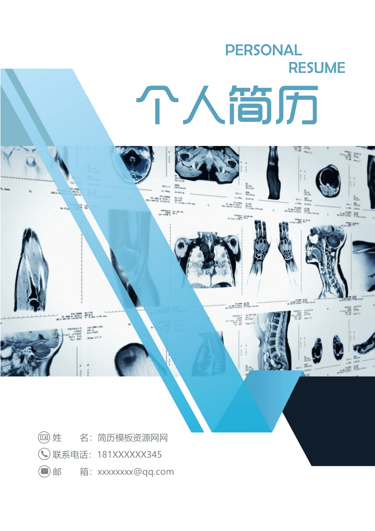 BGBY-3055黑白蓝撞色现代无线交互设计师简历模板/